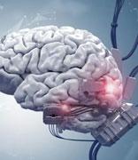 首款侵入式脑机接口医疗器械获批上市